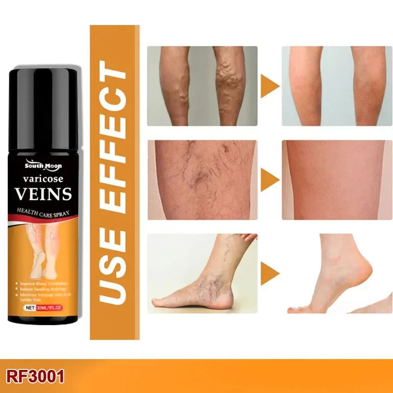 Vein Healing Varicose Veins Spray BUY 1 GET 1 Free
