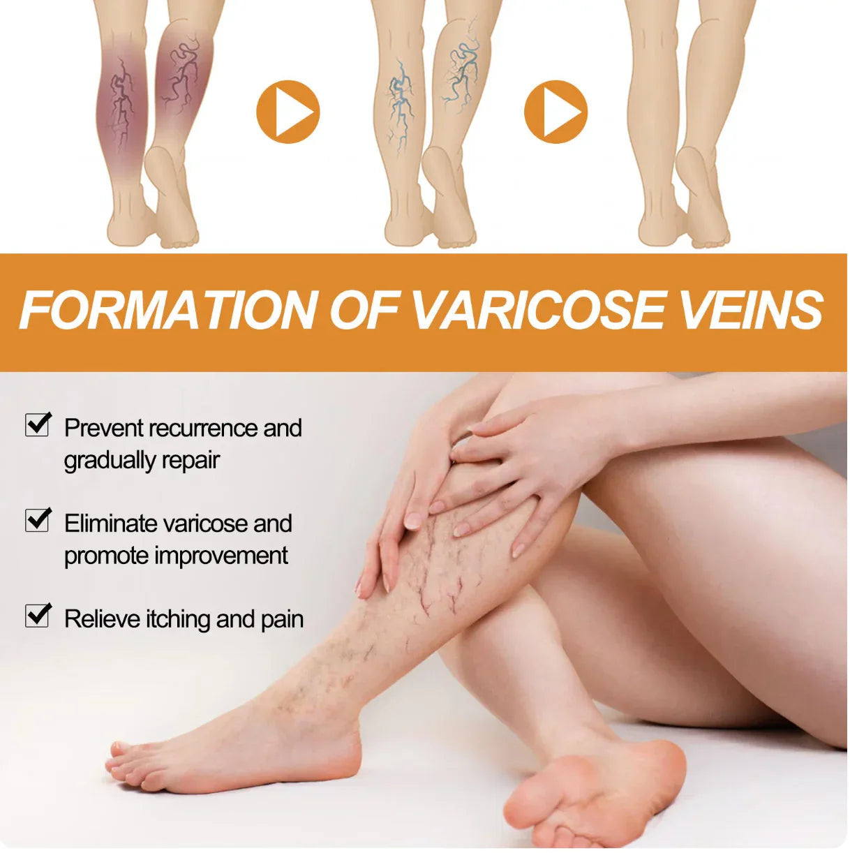 Vein Healing Varicose Veins Spray BUY 1 GET 1 Free