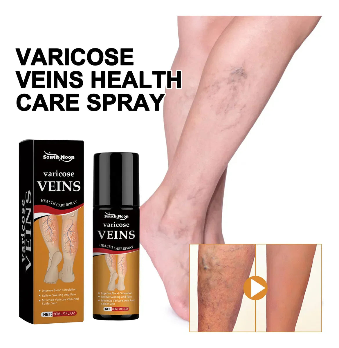 Vein Healing Varicose Veins Spray BUY 1 GET 1 Free
